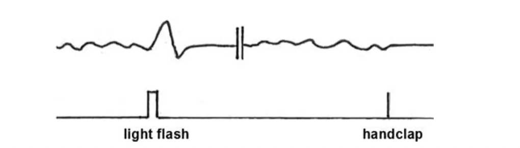 Запись активности мозга после вспышки и хлопка. Источник: Адольф Бек